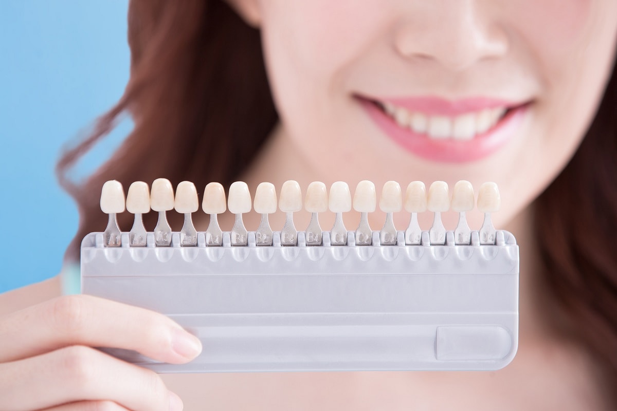 10 facts everyone should know about teeth whitening