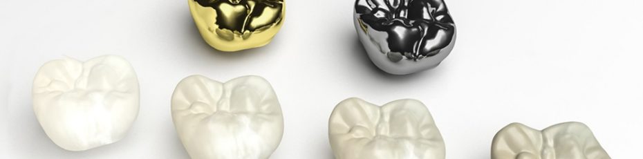 advantages of dental crowns