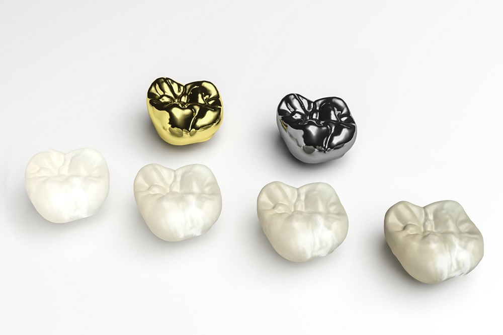 advantages of dental crowns