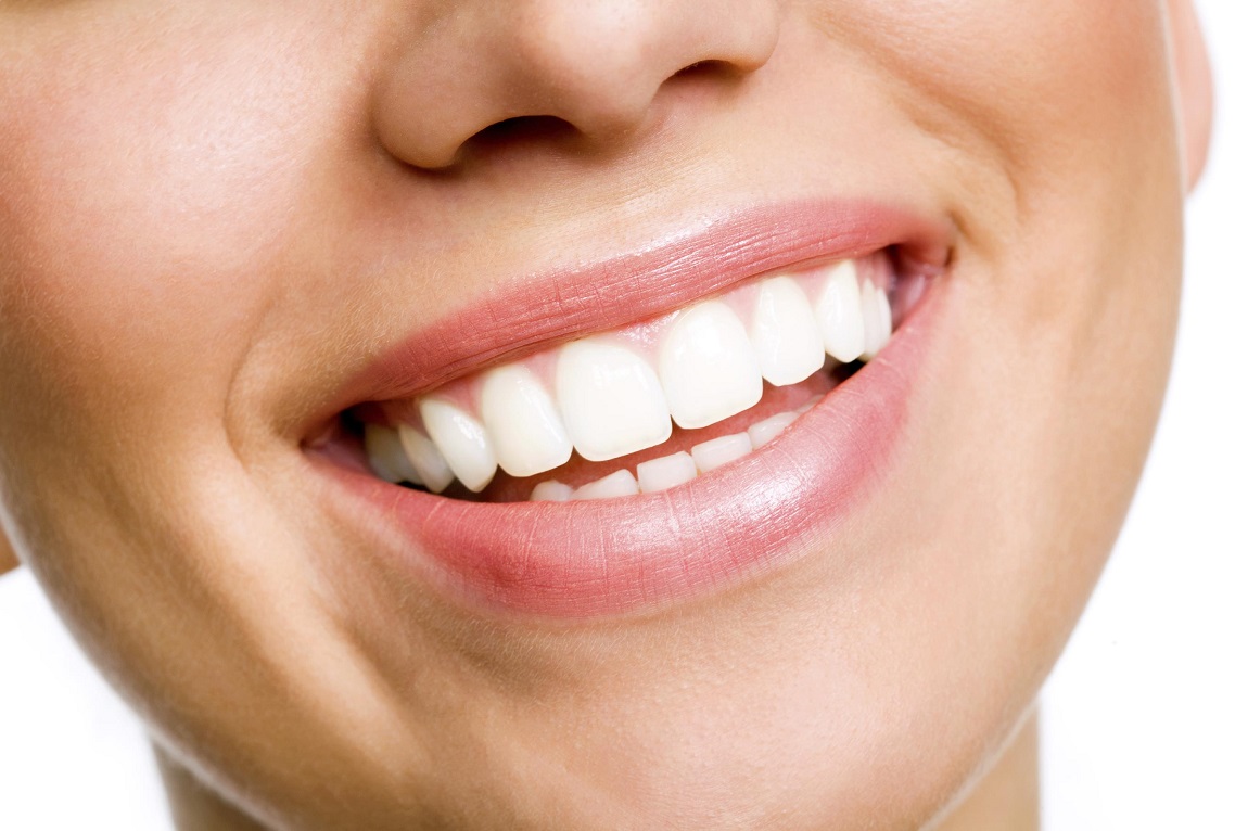 how to prevent your teeth from yellowing after undergoing teeth whitening