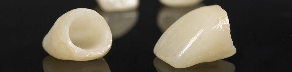do you require dental crowns