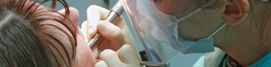 four reasons why you should opt for regular professional teeth cleaning