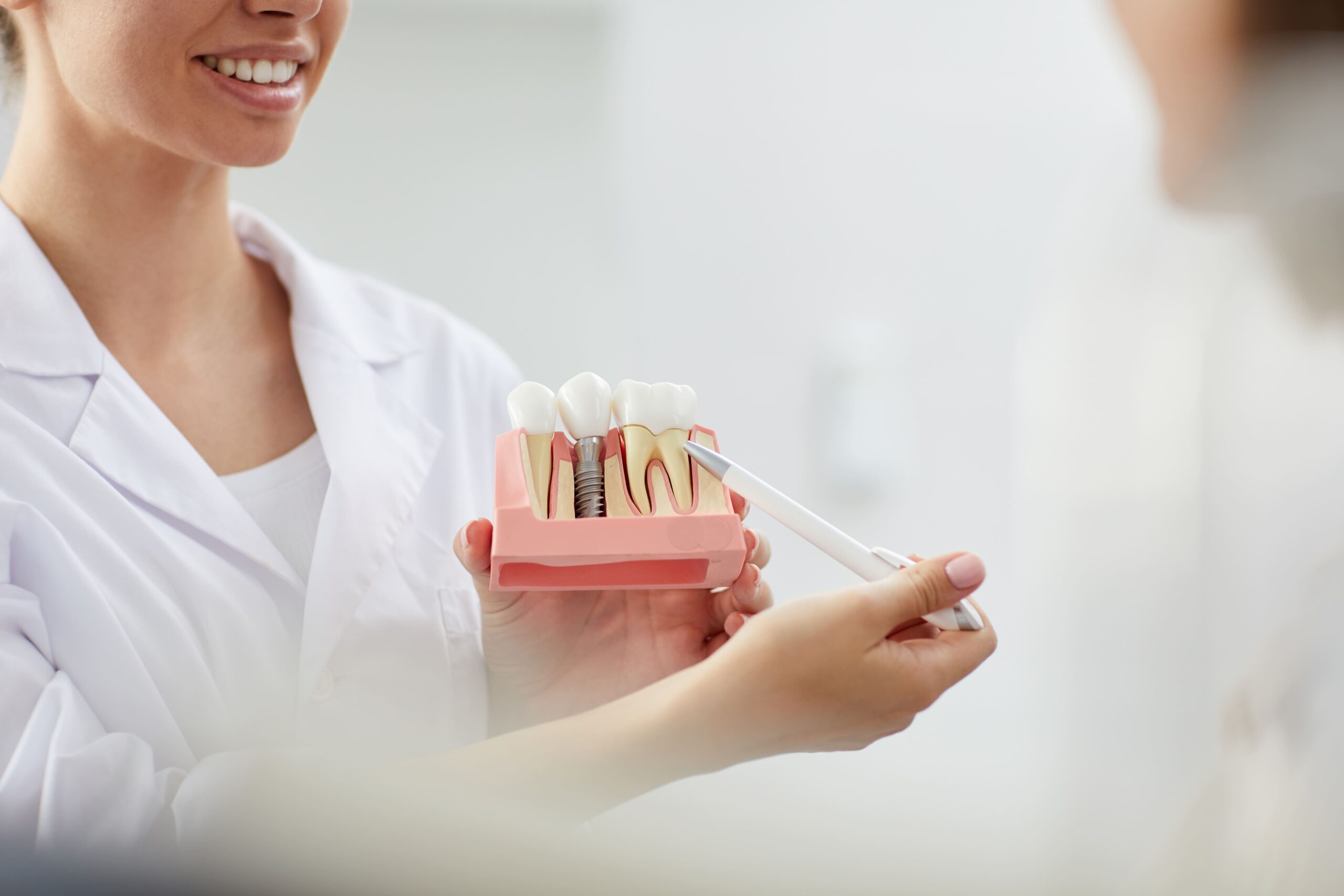 the underrated benefits of dental implants