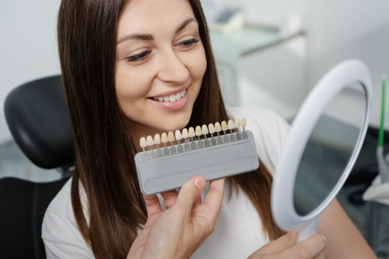 How Long Do Dental Veneers Last?