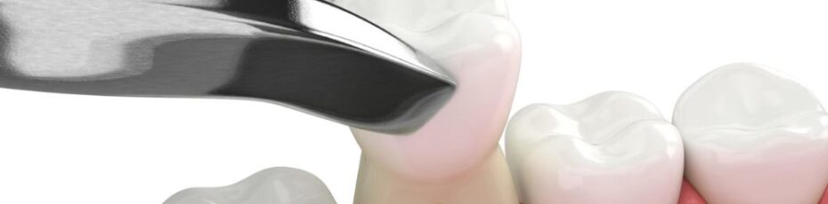 What should you not do before tooth extraction?