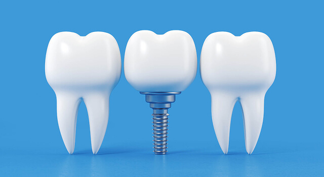 trusted laurelwood dentist