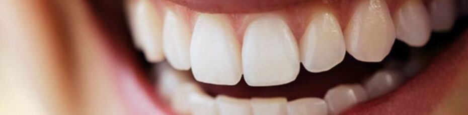 What does a full mouth reconstruction consist of?