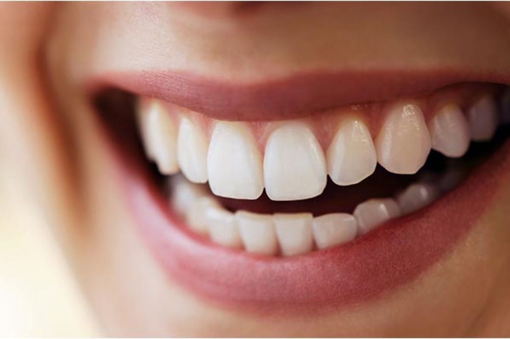 What does a full mouth reconstruction consist of?