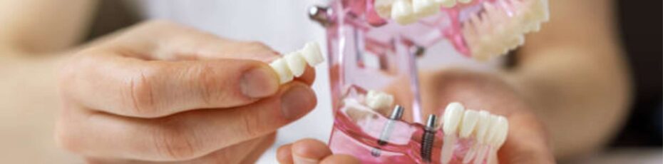 Full set of upper and lower dentures