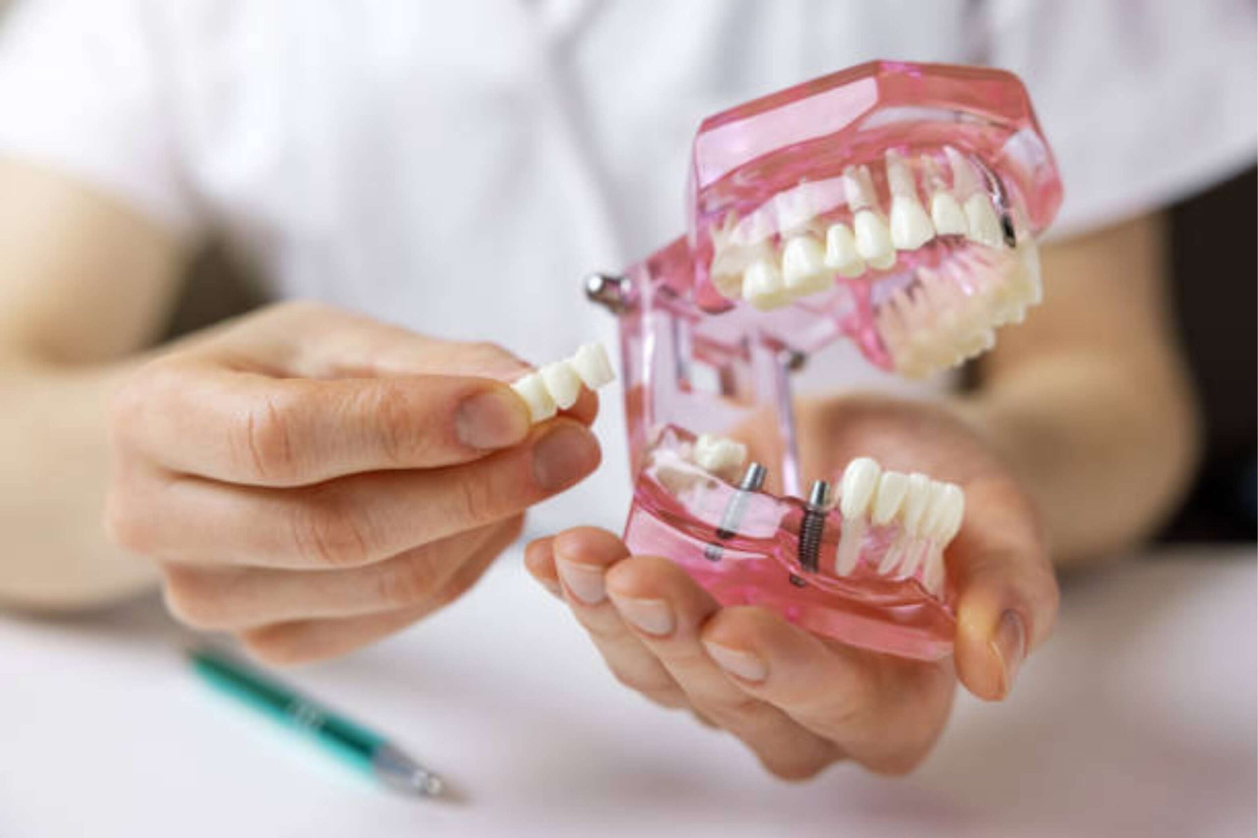 Full set of upper and lower dentures