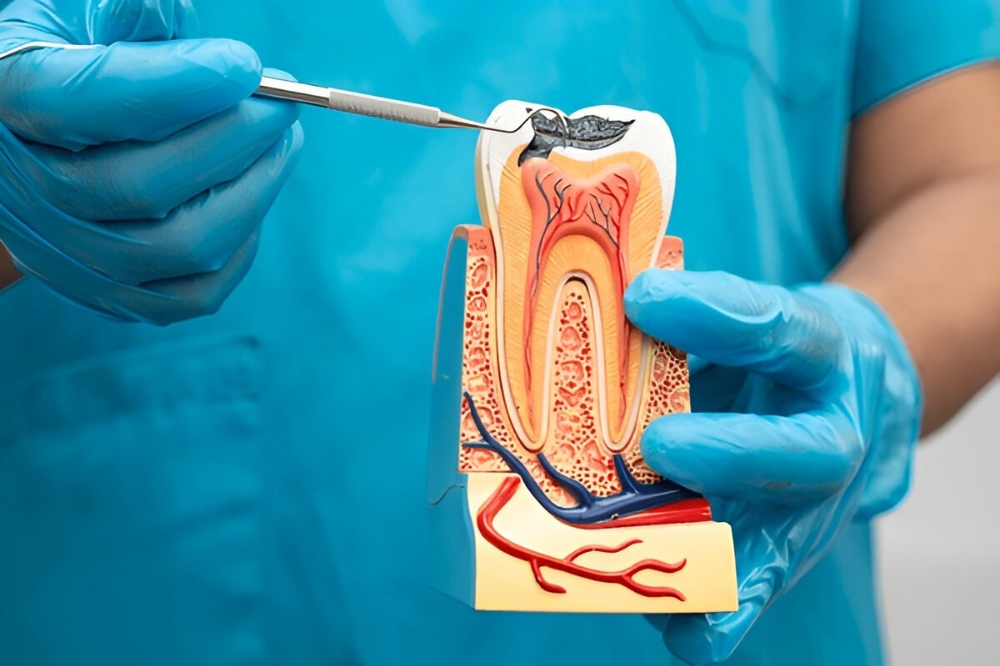 Can a Root Canal Save a Tooth From Extraction? Benefits and Effectiveness