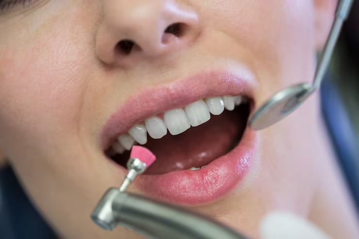 Are you a candidate for dental implants key factors to consider