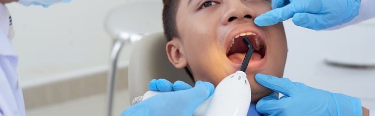 How tooth extraction relieves severe tooth pain quickly